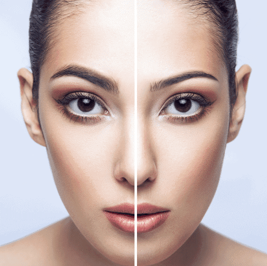 Botox, PRP, and Filler Treatments in NYC | Forbidden Well