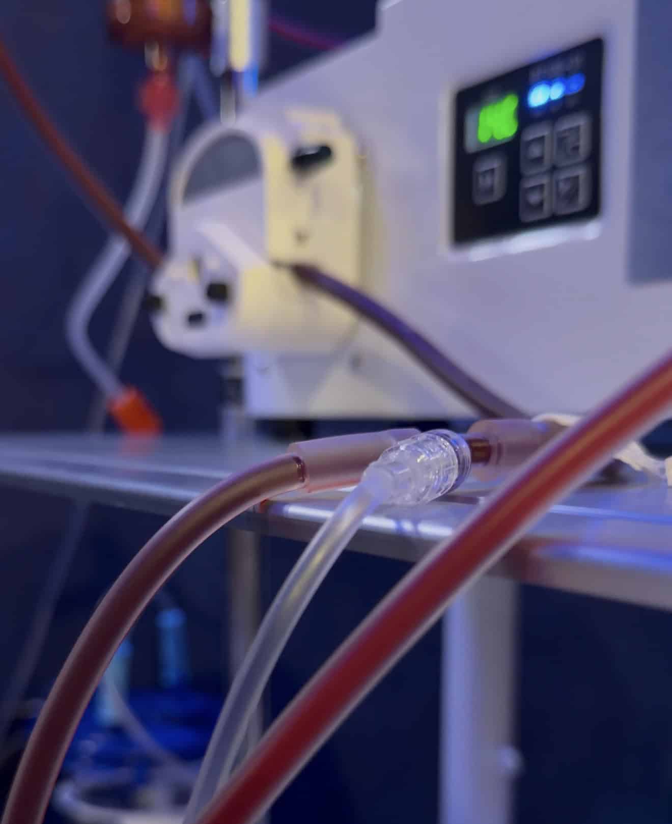 Close-up of medical tubing connected to a dialysis machine in a clinical setting.